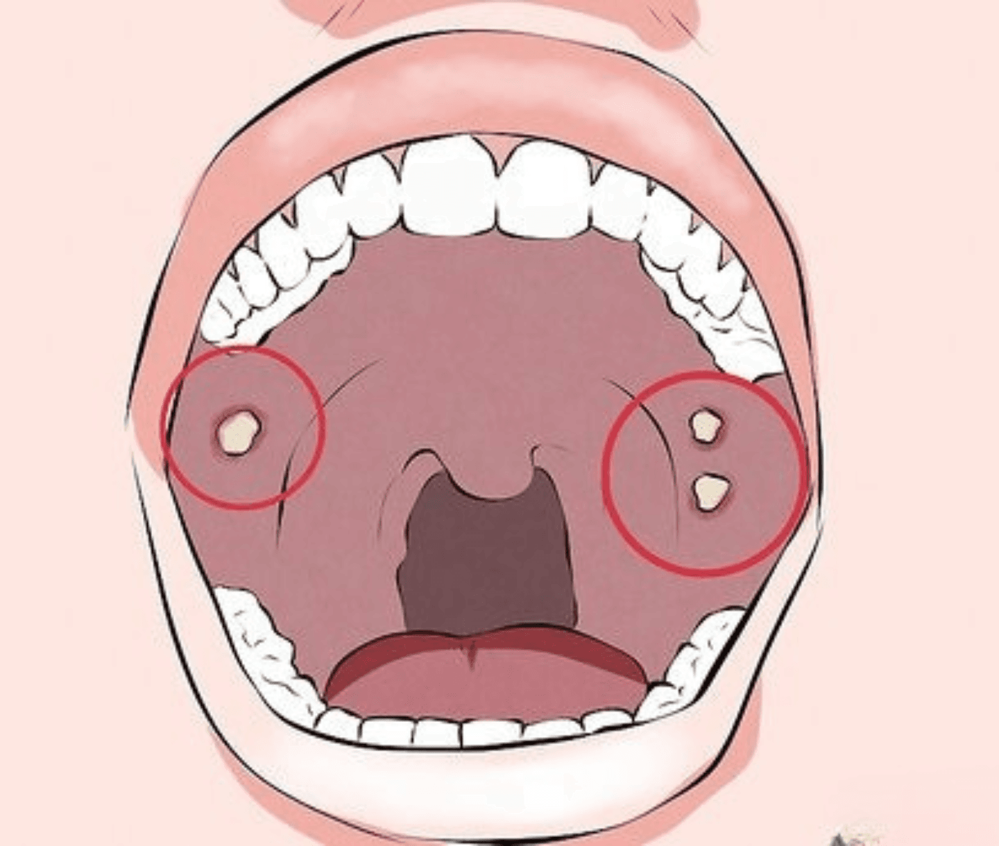 Oral & Head-and-Neck Cancer care at Agastya Oncology